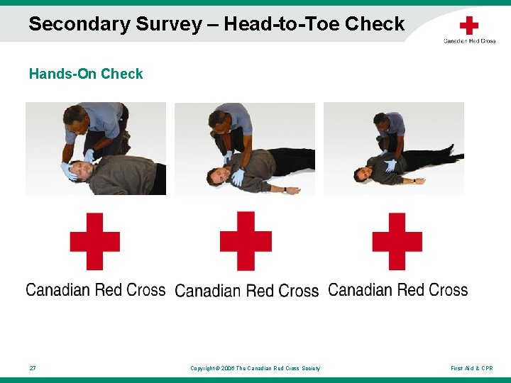 Secondary Survey – Head-to-Toe Check Hands-On Check 27 Copyright © 2006 The Canadian Red Secondary Survey – Head-to-Toe Check Hands-On Check 27 Copyright © 2006 The Canadian Red