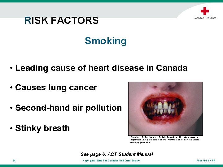 RISK FACTORS Smoking • Leading cause of heart disease in Canada • Causes lung RISK FACTORS Smoking • Leading cause of heart disease in Canada • Causes lung