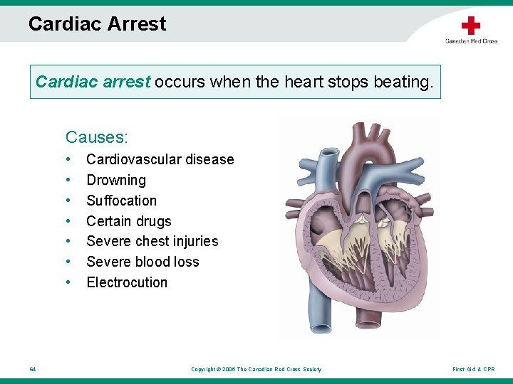 Cardiac Arrest Cardiac arrest occurs when the heart stops beating. Causes: • • 64 Cardiac Arrest Cardiac arrest occurs when the heart stops beating. Causes: • • 64