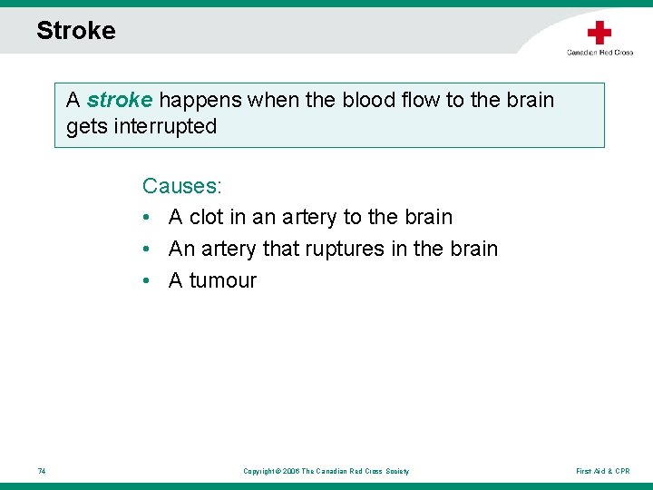 Stroke A stroke happens when the blood flow to the brain gets interrupted Causes: Stroke A stroke happens when the blood flow to the brain gets interrupted Causes:
