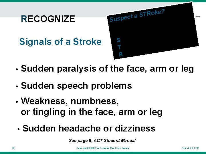 RECOGNIZE Signals of a Stroke e? k o R T ta. S c e RECOGNIZE Signals of a Stroke e? k o R T ta. S c e