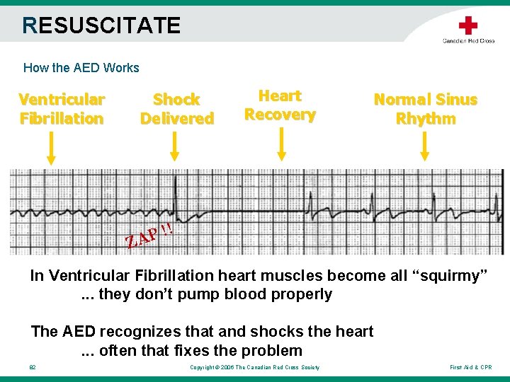 RESUSCITATE How the AED Works Ventricular Fibrillation Shock Delivered Heart Recovery Normal Sinus Rhythm RESUSCITATE How the AED Works Ventricular Fibrillation Shock Delivered Heart Recovery Normal Sinus Rhythm