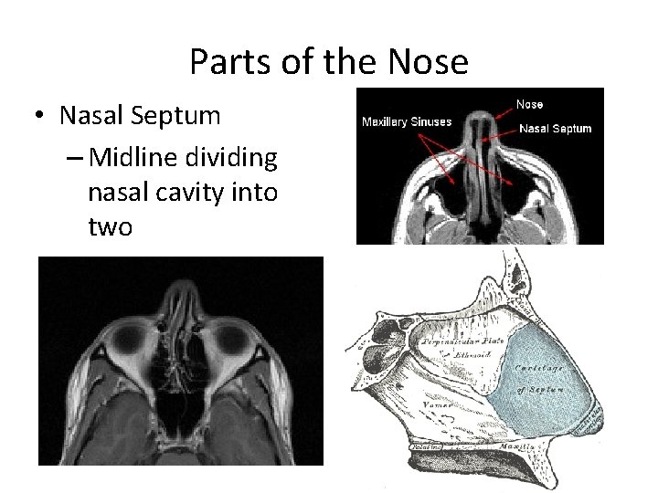 Parts of the Nose • Nasal Septum – Midline dividing nasal cavity into two