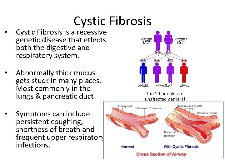 Cystic Fibrosis • Cystic Fibrosis is a recessive genetic disease that effects both the Cystic Fibrosis • Cystic Fibrosis is a recessive genetic disease that effects both the