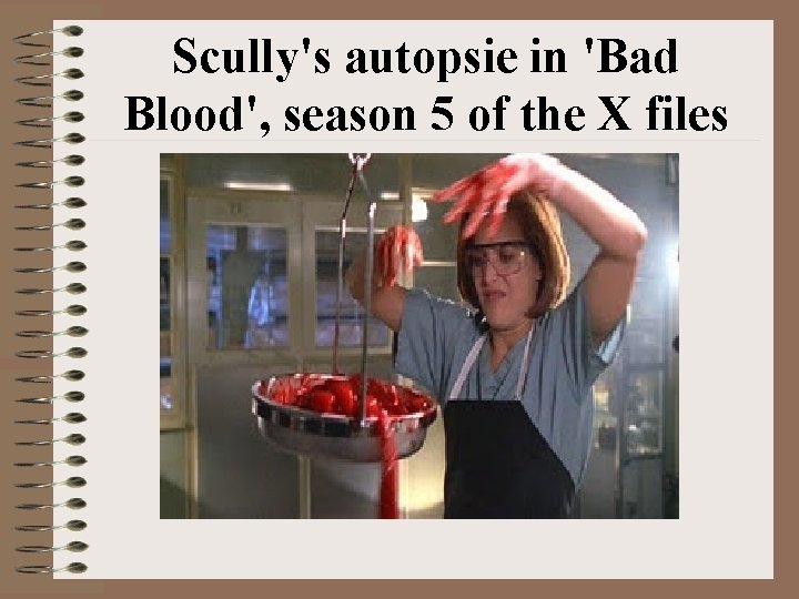 Scully's autopsie in 'Bad Blood', season 5 of the X files 