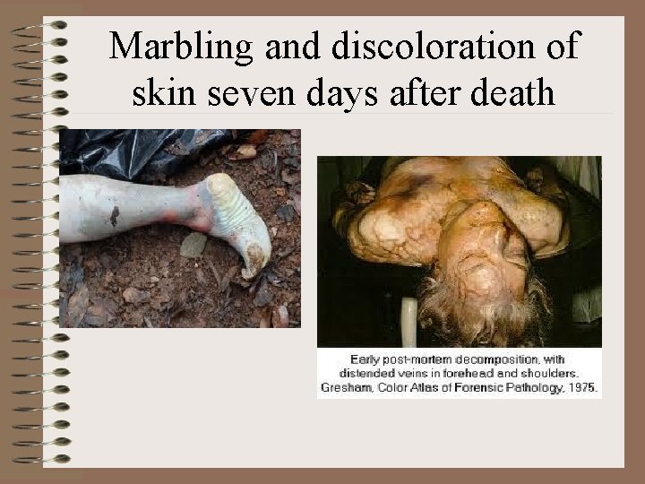 Marbling and discoloration of skin seven days after death 