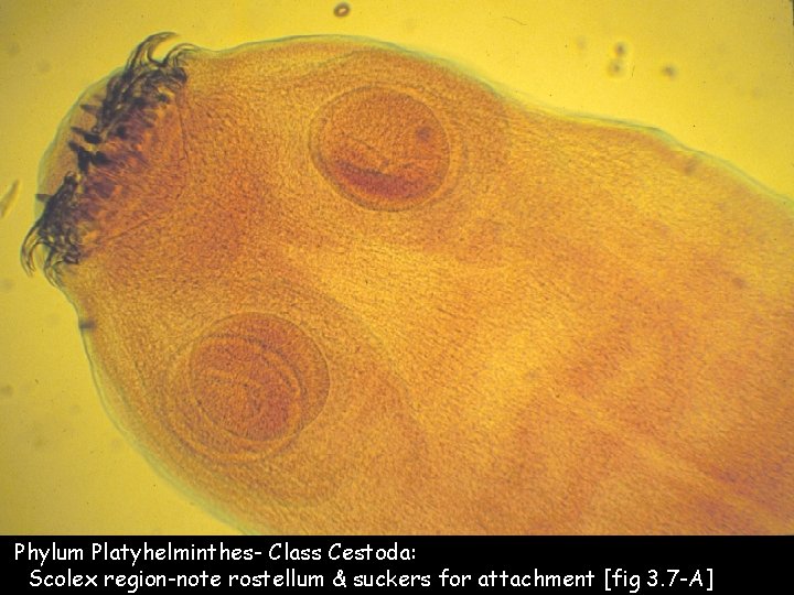 rostellum platyhelminthes vaccino papilloma virus per adulti