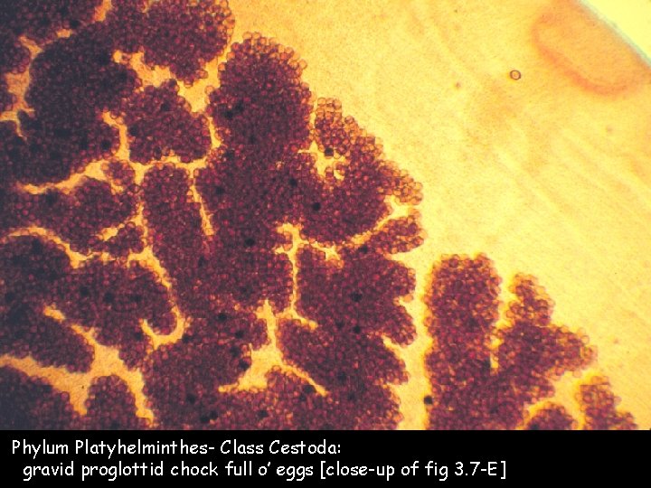 Phylum Platyhelminthes- Class Cestoda: gravid proglottid chock full o’ eggs [close-up of fig 3.