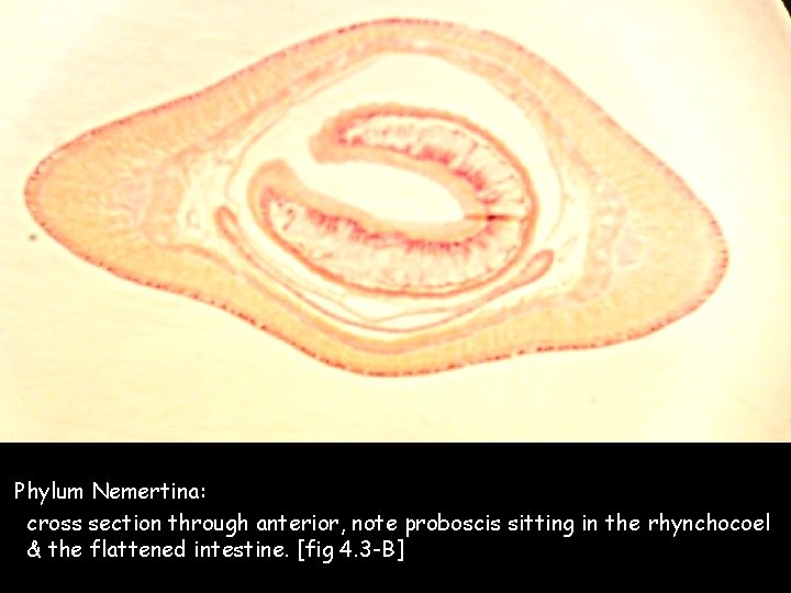 Phylum Nemertina: cross section through anterior, note proboscis sitting in the rhynchocoel & the