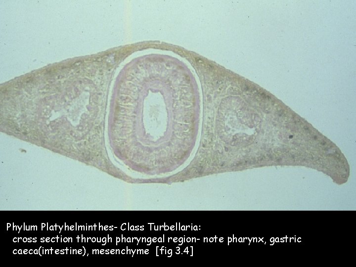 Phylum Platyhelminthes- Class Turbellaria: cross section through pharyngeal region- note pharynx, gastric caeca(intestine), mesenchyme