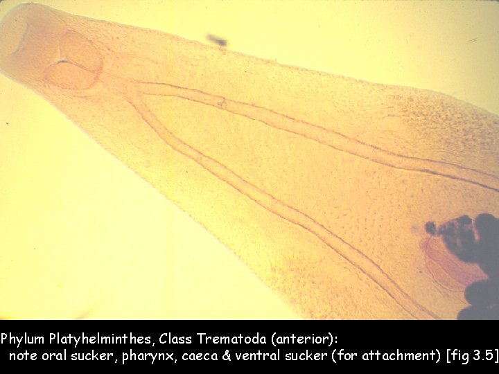 Phylum Platyhelminthes, Class Trematoda (anterior): note oral sucker, pharynx, caeca & ventral sucker (for