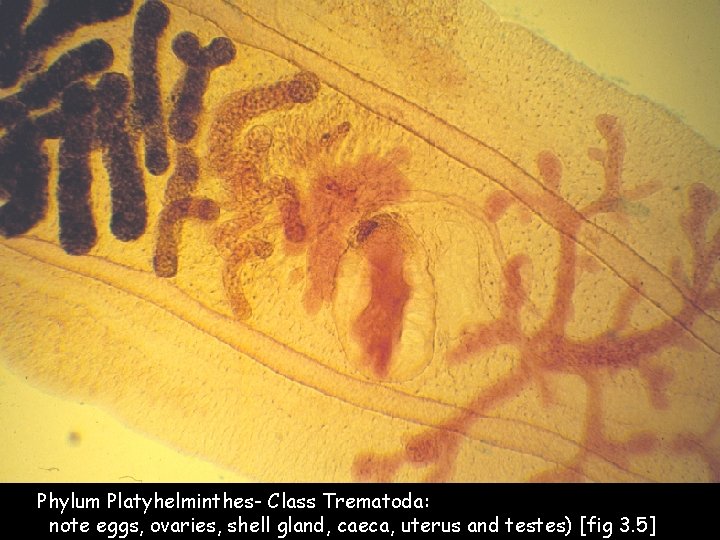 Phylum Platyhelminthes- Class Trematoda: note eggs, ovaries, shell gland, caeca, uterus and testes) [fig