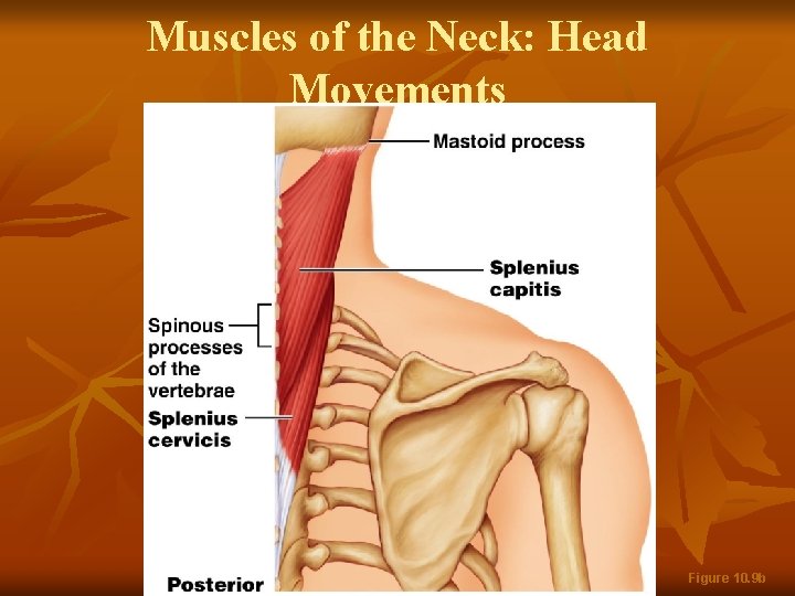 Muscles of the Neck: Head Movements Figure 10. 9 b 