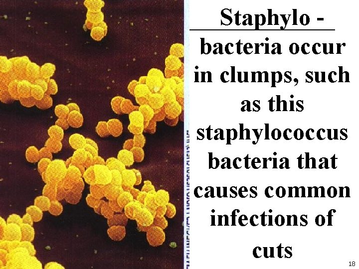 Staphylo bacteria occur in clumps, such as this staphylococcus bacteria that causes common infections