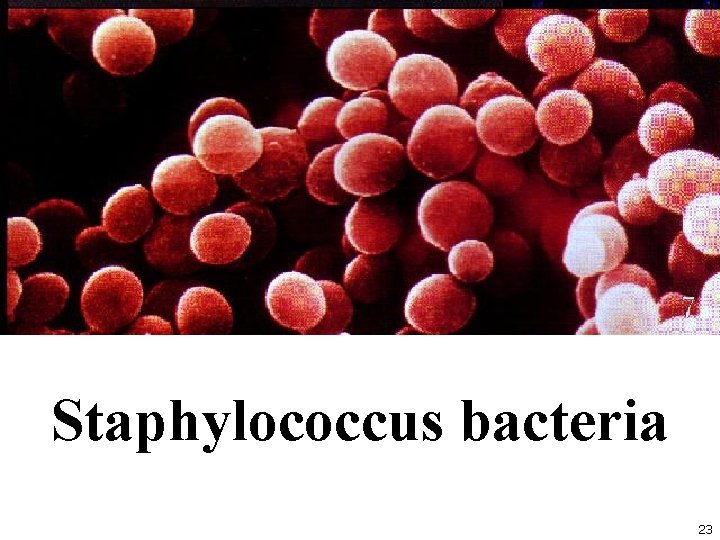 Staphylococcus bacteria 23 