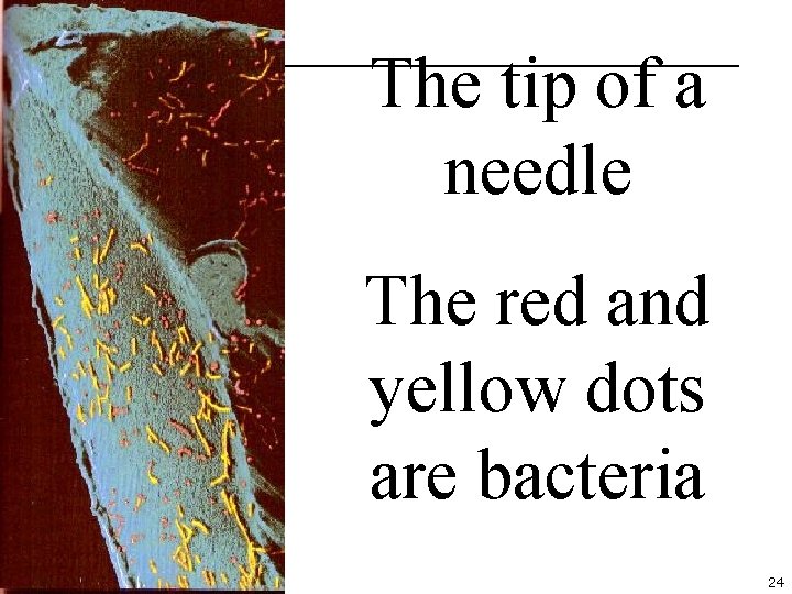 The tip of a needle The red and yellow dots are bacteria 24 