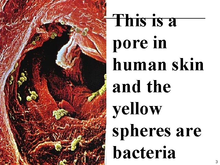 This is a pore in human skin and the yellow spheres are bacteria 3