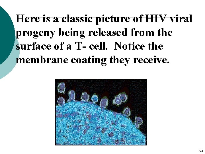 Here is a classic picture of HIV viral progeny being released from the surface