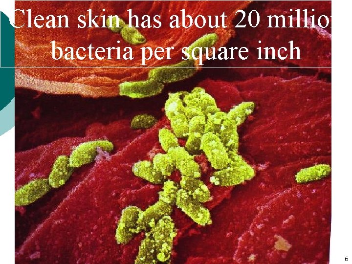 Clean skin has about 20 million bacteria per square inch 6 