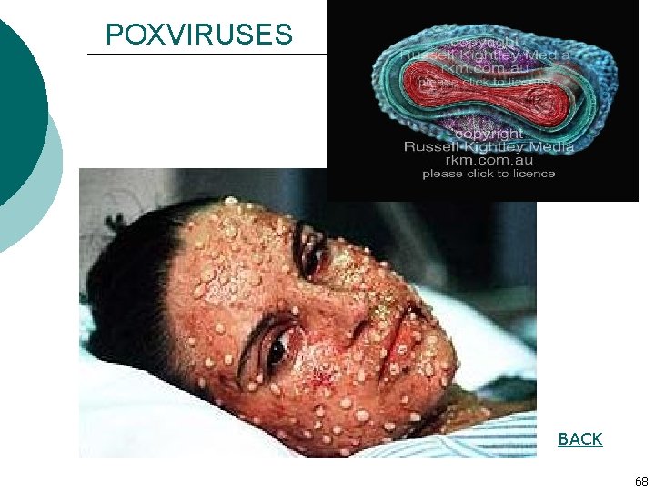 POXVIRUSES BACK 68 