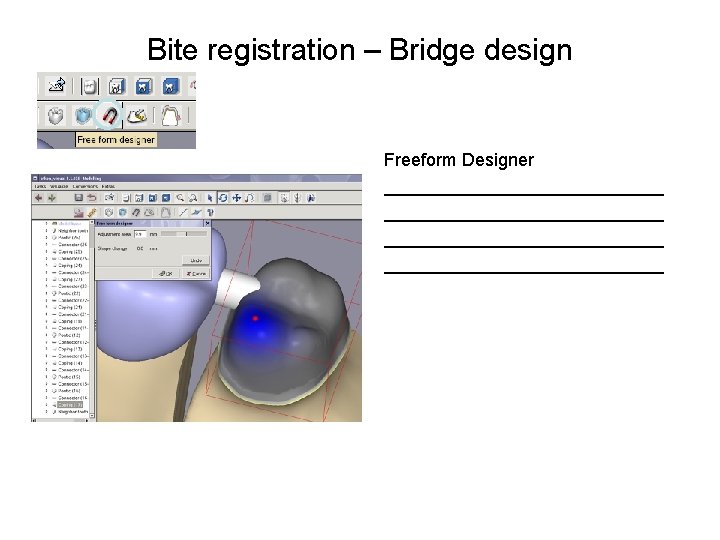 Bite registration – Bridge design Freeform Designer ____________________________ 