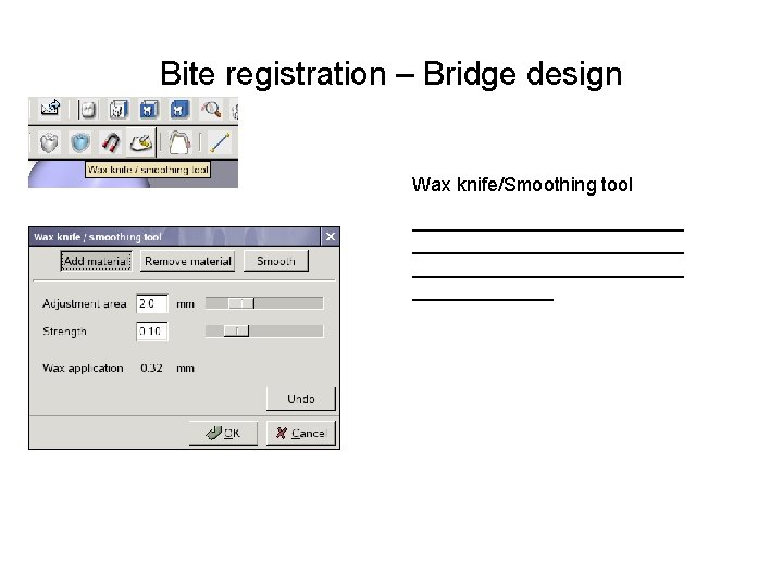 Bite registration – Bridge design Wax knife/Smoothing tool _________________________ _______ 