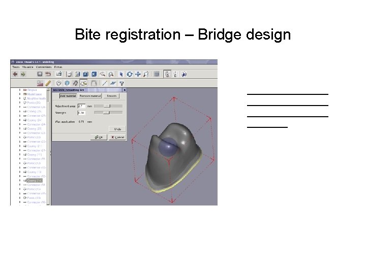 Bite registration – Bridge design ________________ ____ 