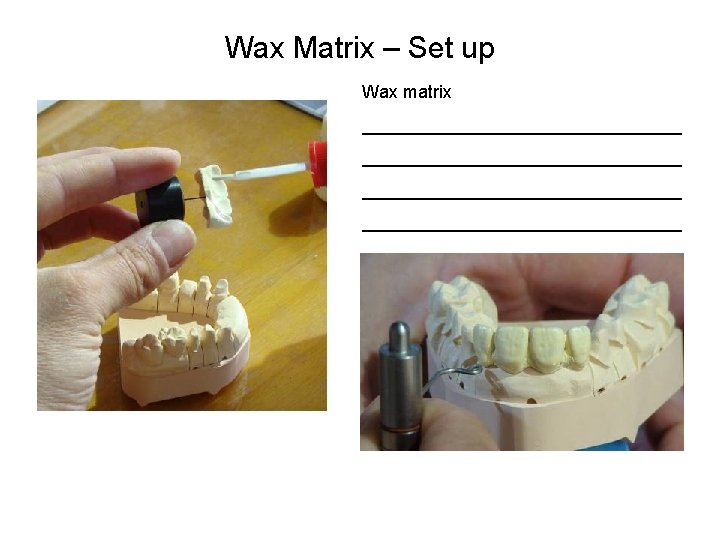 Wax Matrix – Set up Wax matrix ________________________________ 