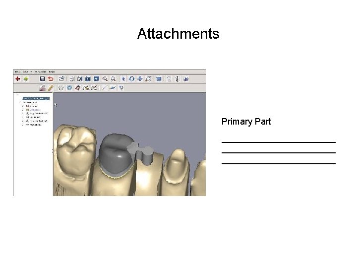 Attachments Primary Part _______________________ 