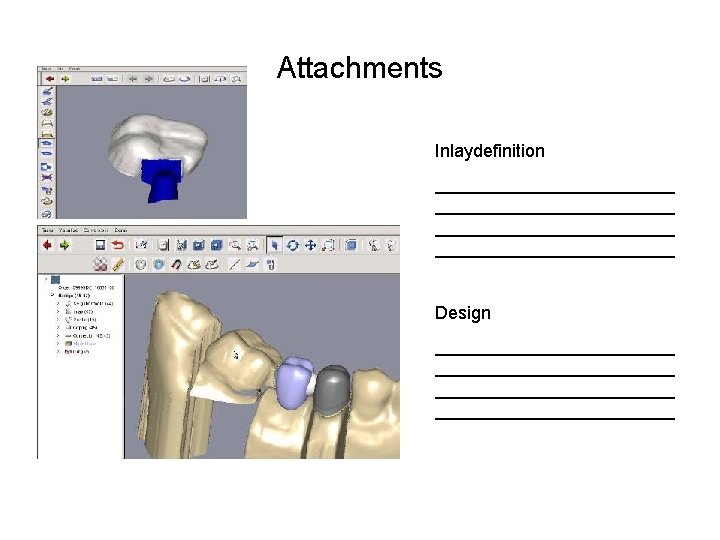 Attachments Inlaydefinition ________________________ Design ________________________ 