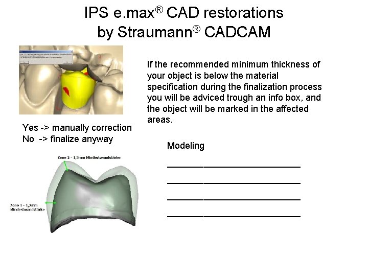 IPS e. max® CAD restorations by Straumann® CADCAM Yes -> manually correction No ->