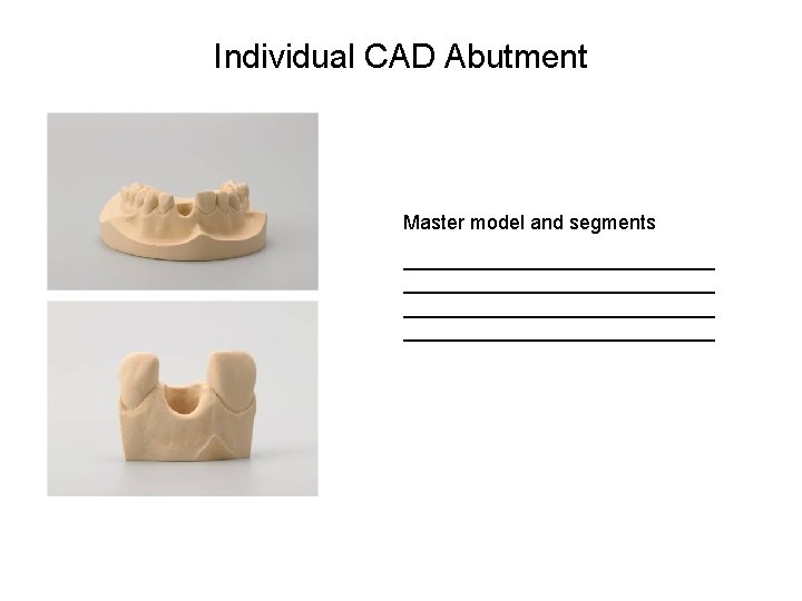 Individual CAD Abutment Master model and segments ____________________________ 