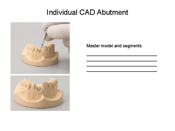 Individual CAD Abutment Master model and segments _____________________________ 