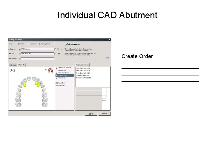 Individual CAD Abutment Create Order __________________________ 