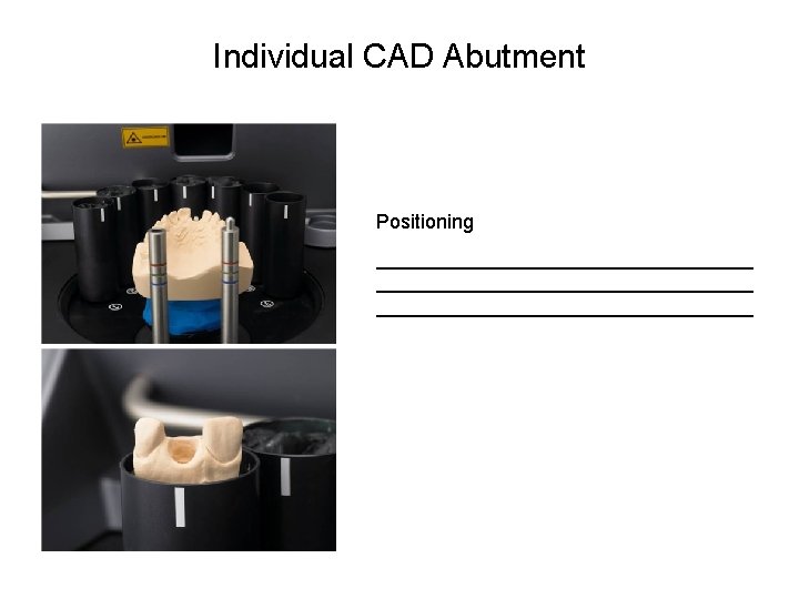 Individual CAD Abutment Positioning __________________________________ 