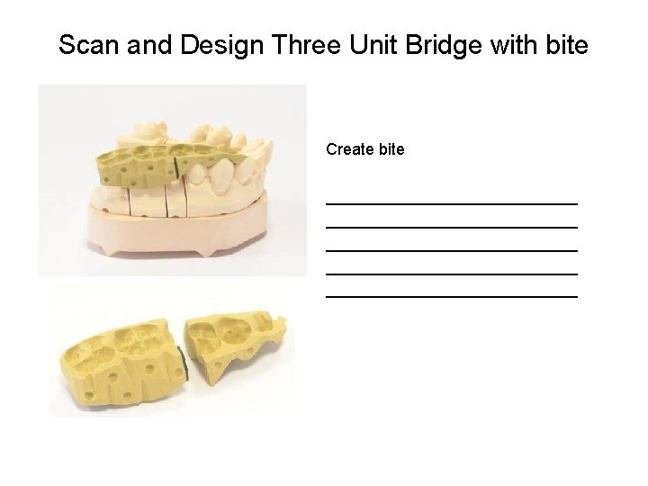 Scan and Design Three Unit Bridge with bite Create bite ____________________________ ______________ 