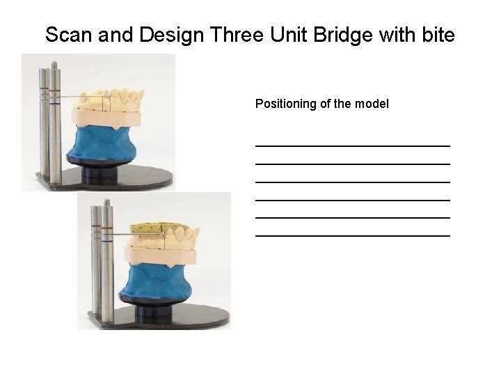 Scan and Design Three Unit Bridge with bite Positioning of the model ____________________________ ____________________________