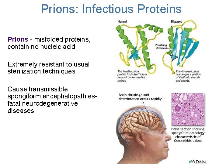 Prions: Infectious Proteins Prions - misfolded proteins, contain no nucleic acid Extremely resistant to