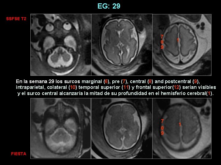 EG: 29 SSFSE T 2 7 8 9 1 En la semana 29 los