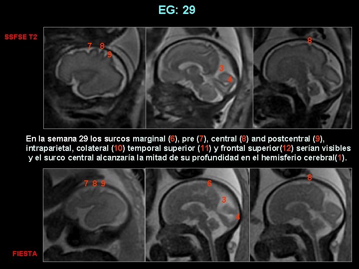 EG: 29 SSFSE T 2 7 8 8 9 3 4 En la semana