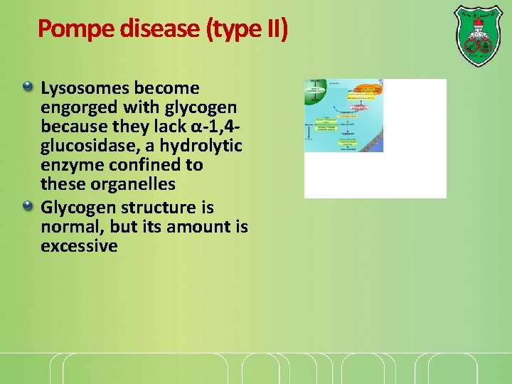 Pompe disease (type II) Lysosomes become engorged with glycogen because they lack α-1, 4