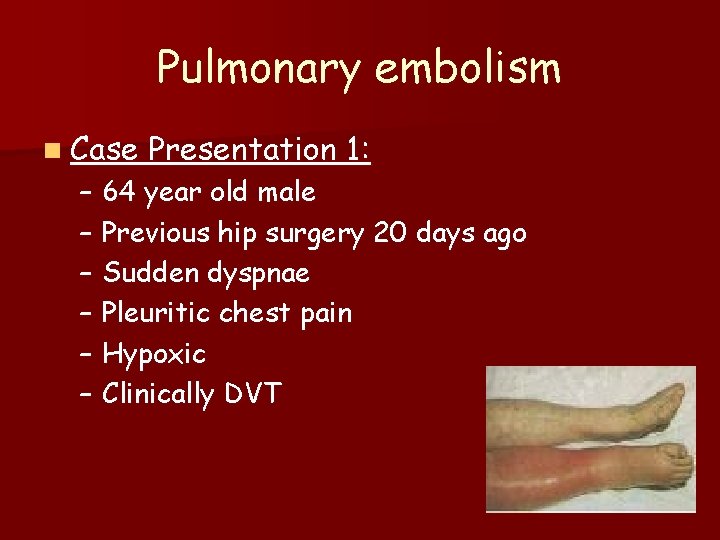 Pulmonary embolism n Case Presentation 1: – 64 year old male – Previous hip
