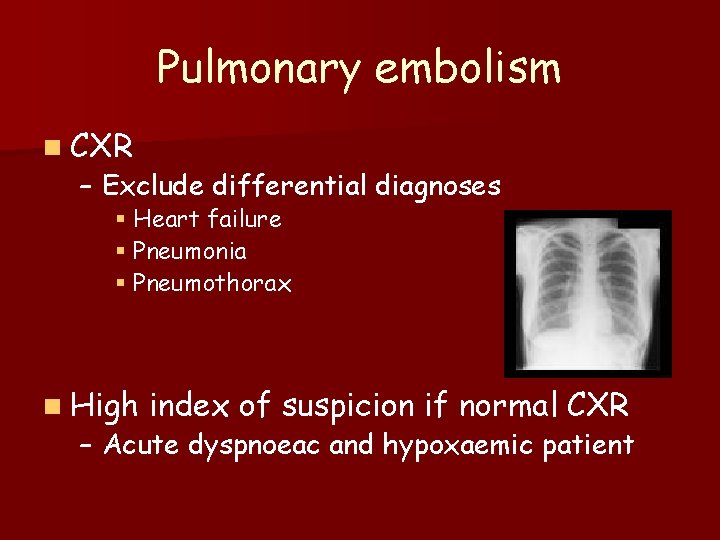 Pulmonary embolism n CXR – Exclude differential diagnoses § Heart failure § Pneumonia §