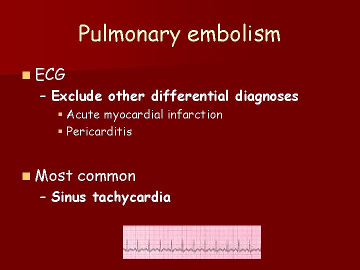 Pulmonary embolism n ECG – Exclude other differential diagnoses § Acute myocardial infarction §