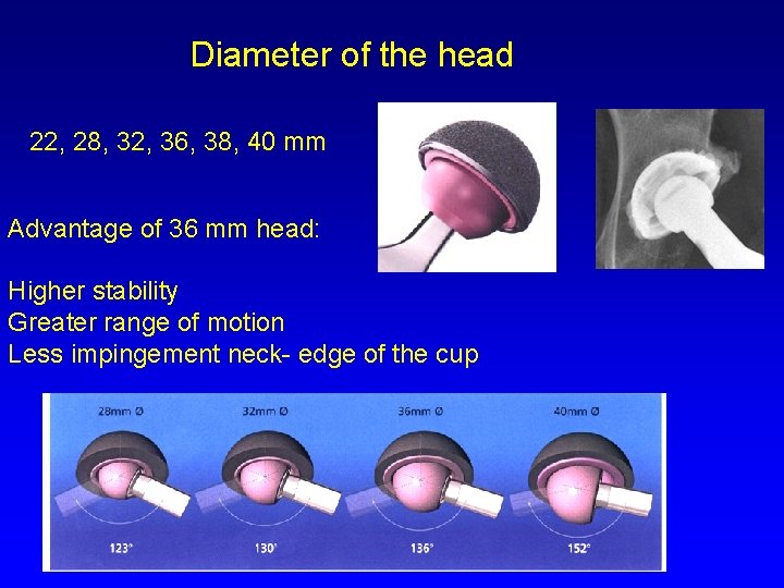 Diameter of the head 22, 28, 32, 36, 38, 40 mm Advantage of 36