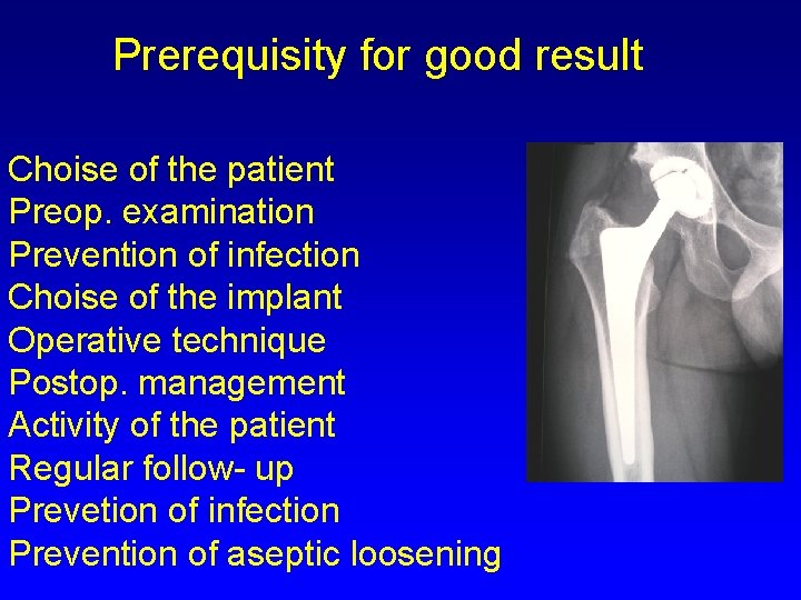 Prerequisity for good result Choise of the patient Preop. examination Prevention of infection Choise