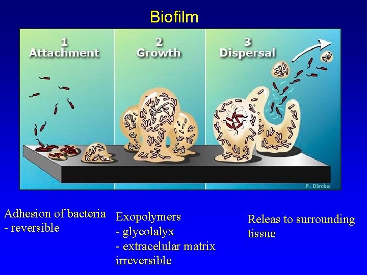 Biofilm Adhesion of bacteria Exopolymers - reversible - glycolalyx - extracelular matrix irreversible Releas
