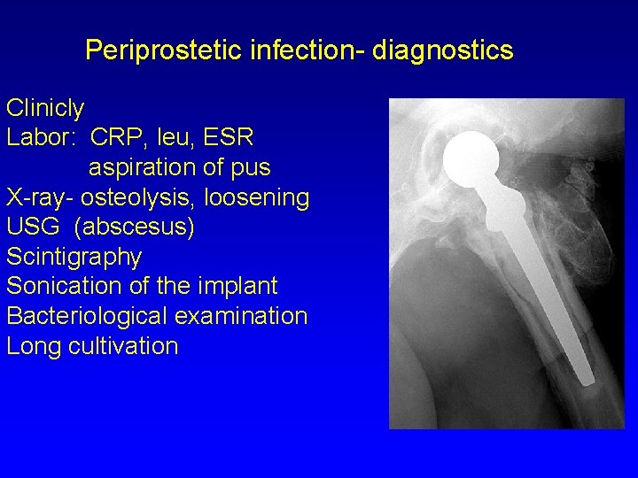 Periprostetic infection- diagnostics Clinicly Labor: CRP, leu, ESR aspiration of pus X-ray- osteolysis, loosening