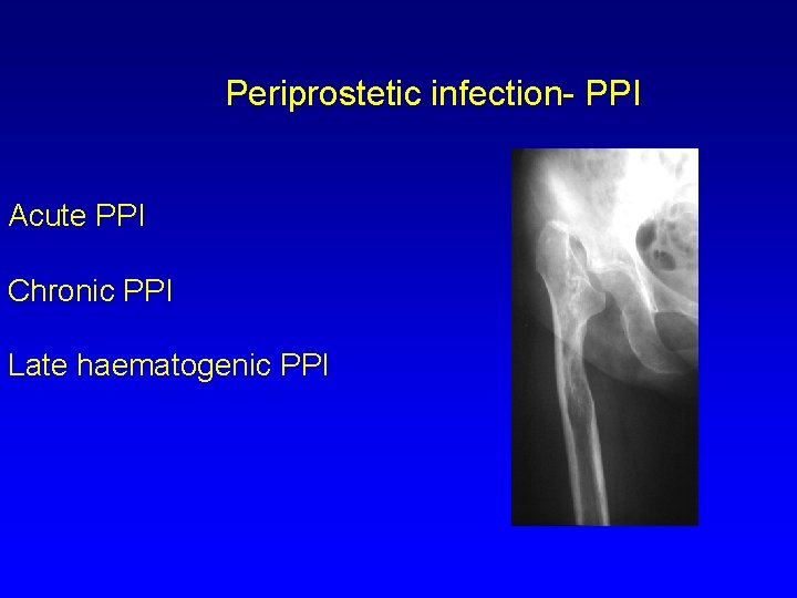 Periprostetic infection- PPI Acute PPI Chronic PPI Late haematogenic PPI 