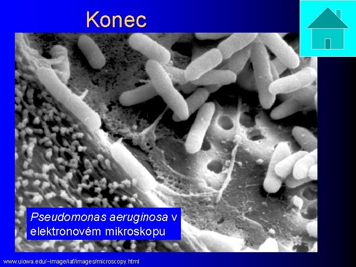 Konec Pseudomonas aeruginosa v elektronovém mikroskopu www. uiowa. edu/~image/iaf/images/microscopy. html 